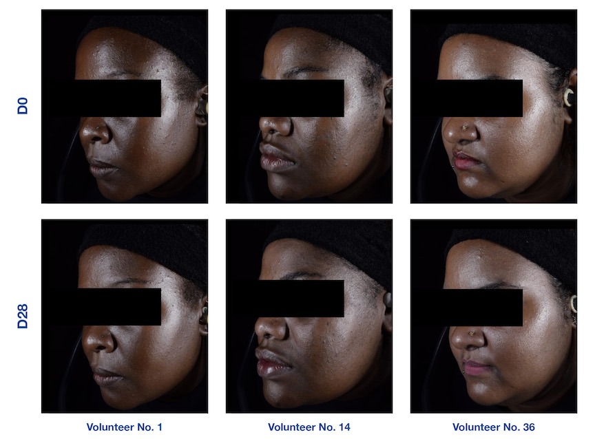 Effet de Bix’Activ sur l’éclat de la peau chez trois femmes volontaires africaines. D0 = avant traitement, D28 = après 28 jours d’application du produit