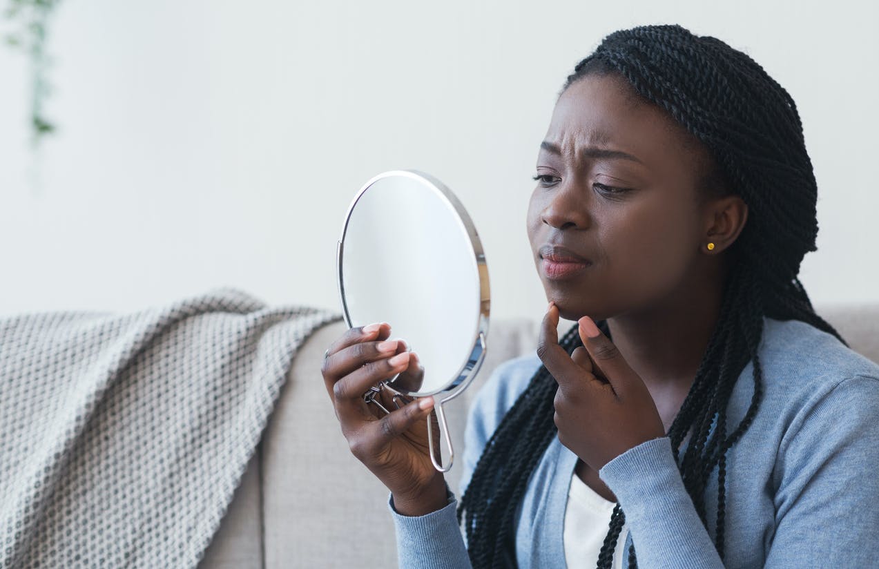 Peau noire : 5 points essentiels à connaître sur votre acné