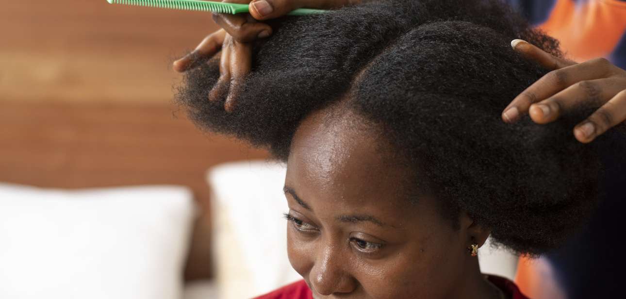 pellicules-cheveux-afro-particuliers-setalmaa